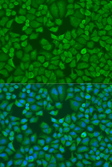 Anti-IGF2BP1 Antibody (CAB1517)