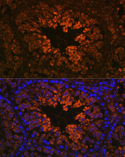 Anti-RTN4 Antibody (CAB1752)