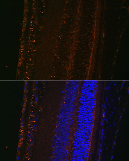 Anti-LOXL1 Antibody (CAB10191)