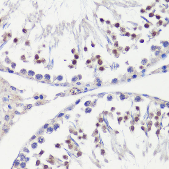 Anti-HFM1 Polyclonal Antibody (CAB8600)