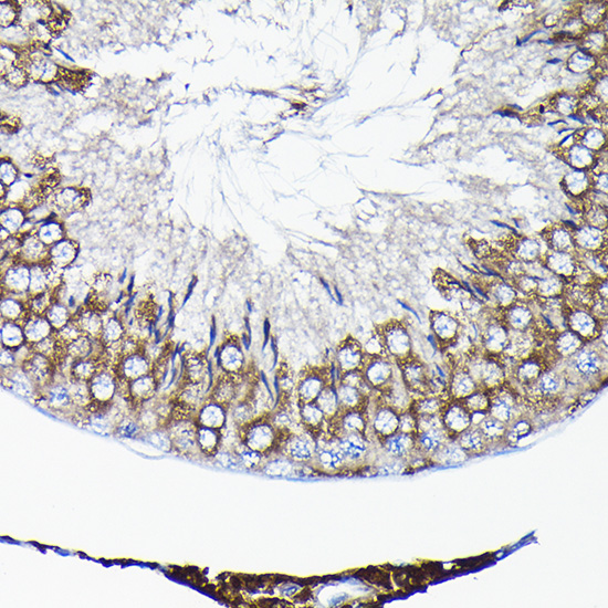 Anti-TCP1 Antibody (CAB13364)