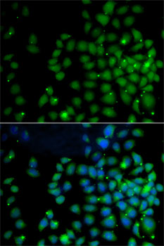 Anti-UBD Antibody (CAB5491)