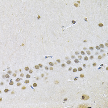 Anti-OTX2 Antibody (CAB14036)