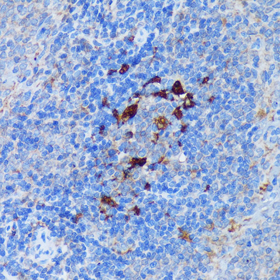 Anti-PADI4 Antibody (CAB16188)