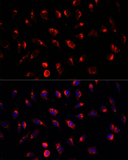 Anti-GALNT2 Antibody (CAB6910)