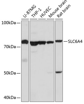 Anti-SLC6A4 Antibody (CAB14171)