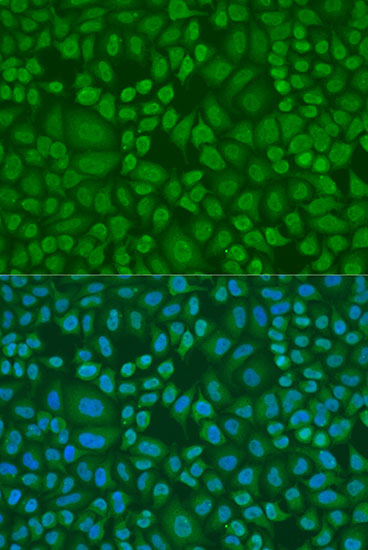 Anti-Ribonuclease 3 Polyclonal Antibody (CAB8336)