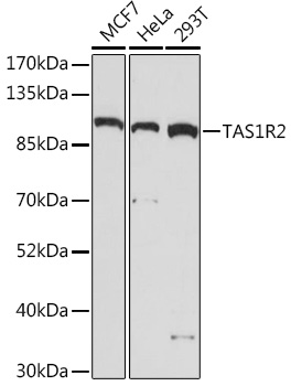 Anti-TAS1R2 Antibody (CAB17218)