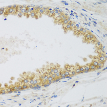 Anti-SIRT3 Antibody (CAB5419)