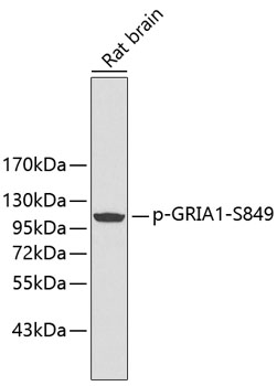 Anti-Phospho-GRIA1-S849 Antibody (CABP0242)