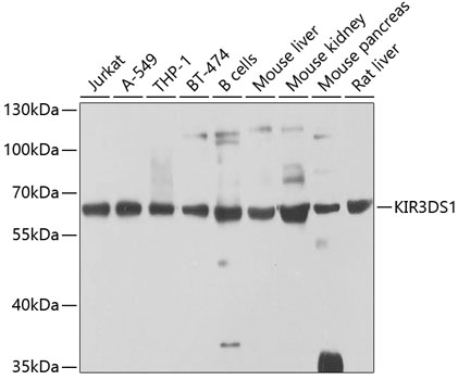 Anti-KIR3DS1 Polyclonal Antibody (CAB9936)