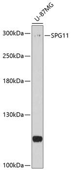 Anti-SPG11 Antibody (CAB10326)