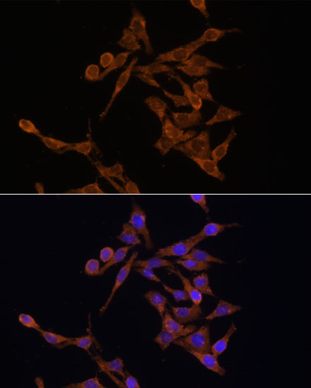 Anti-UBE2J1 Antibody (CAB15841)