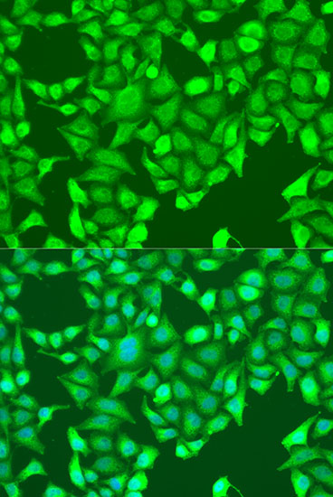 Anti-AURKA Antibody (CAB15728)