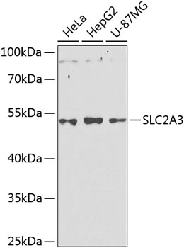 Anti-SLC2A3 Polyclonal Antibody (CAB8150)