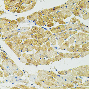 Anti-RALBP1 Antibody [KO Validated] (CAB1140)