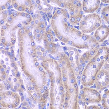 Anti-ACAA1 Antibody (CAB7422)