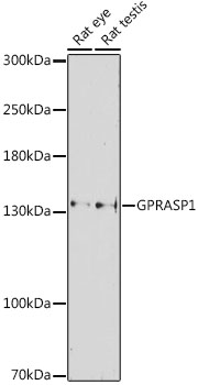 Anti-GPRASP1 Antibody (CAB16090)
