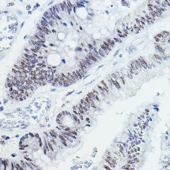 Anti-NCOR1 Antibody (CAB7046)