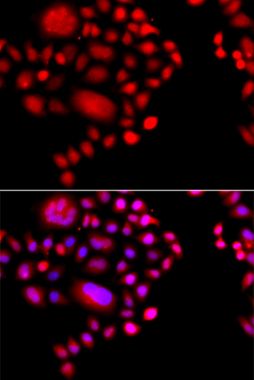 Anti-POLR1D Polyclonal Antibody (CAB8021)