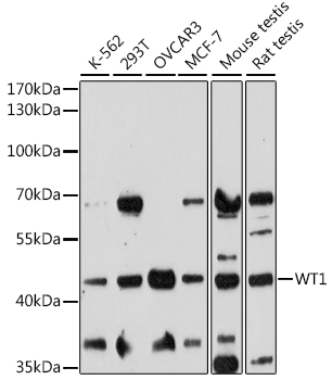 Anti-WT1 Antibody (CAB16319)