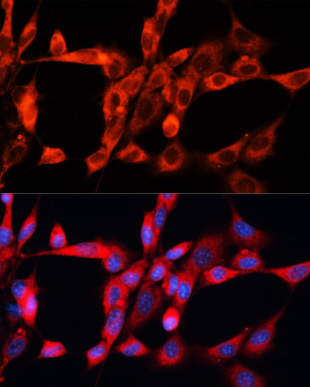 Anti-STX2 Antibody (CAB10444)