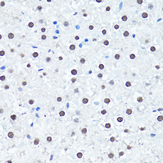 Anti-Symmetric DiMethyl-Histone H4-R3 Antibody (CAB3159)