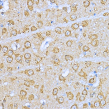 Anti-Hsp90 alpha Antibody (CAB12448)