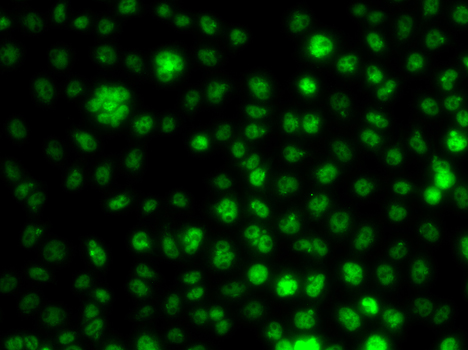 Anti-UBE2R2 Antibody (CAB7373)