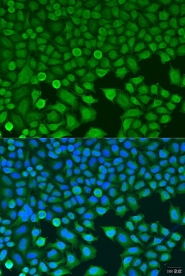 Anti-BCKDK Polyclonal Antibody (CAB8184)