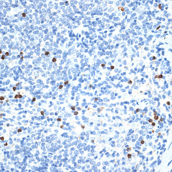 Anti-MMP9 Antibody (CAB0289)