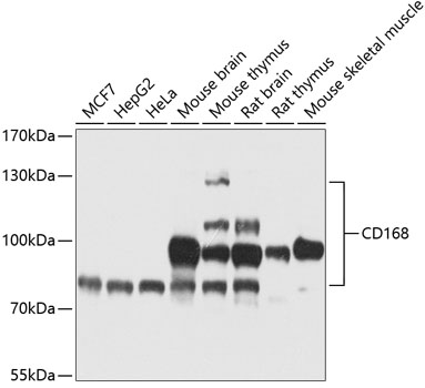 Anti-CD168 Antibody (CAB13315)