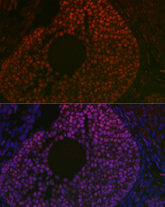 Anti-FOXL2 Antibody (CAB16244)