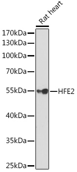 Anti-HFE2 Antibody (CAB5348)