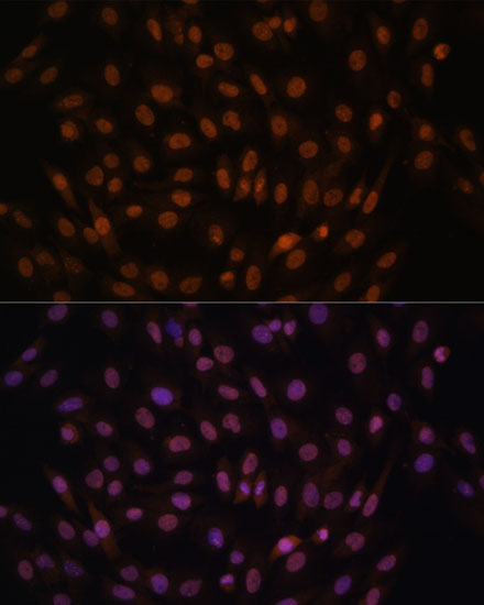 Anti-FCF1 Antibody (CAB17149)