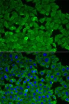 Anti-EEF2K Antibody [KO Validated] (CAB5404)