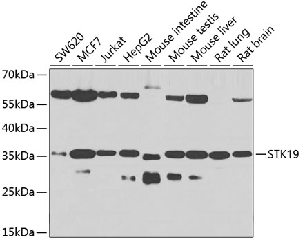 Anti-STK19 Antibody (CAB7574)