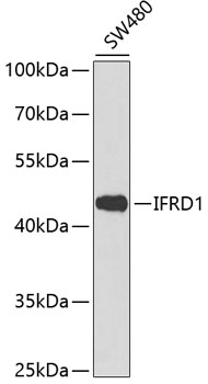 Anti-IFRD1 Antibody (CAB13318)