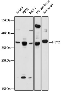 Anti-HEY2 Antibody (CAB15143)