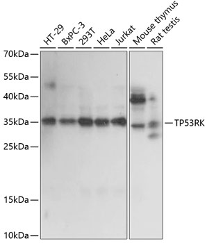 Anti-TP53RK Antibody (CAB14952)