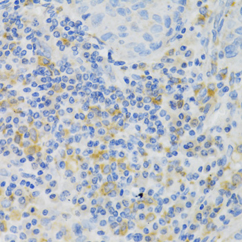 Anti-PAK1 Antibody (CAB3279)