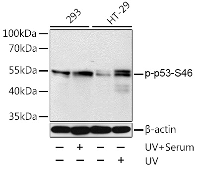 Anti-Phospho-p53-S46 Antibody (CABP0476)