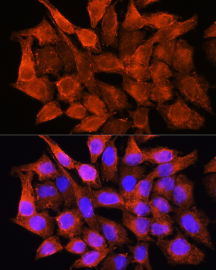 Anti-AMT Polyclonal Antibody (CAB9926)