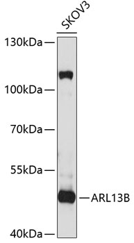 Anti-ARL13B Antibody (CAB5200)