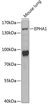 Anti-EPHA1 Antibody (CAB13301)