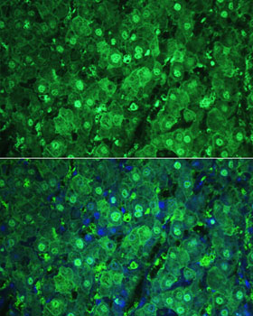 Anti-ARG1 / Arginase 1 Antibody (CAB1847)