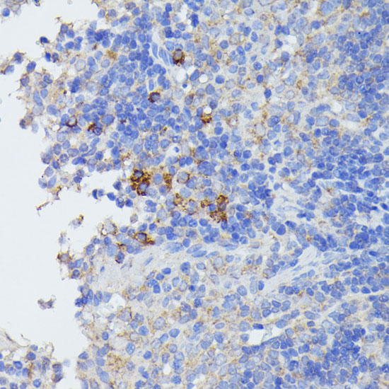 Anti-STAT1 Antibody (CAB12075)