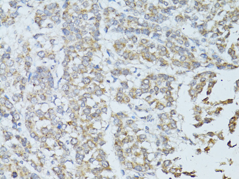 Anti-TEFM Polyclonal Antibody (CAB8511)
