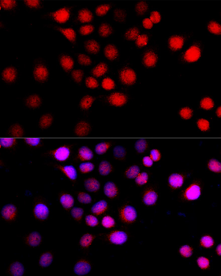 Anti-Beclin 1 Antibody [KO Validated] (CAB7353)