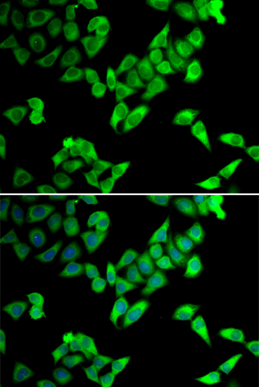 Anti-TRIP10 Antibody (CAB7038)